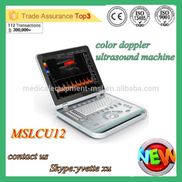 MSLCU12M Máquina de ultrasonido Protable 3D Máquina de ultrasonido Dopple color Escáner de ultrasonido barato protable